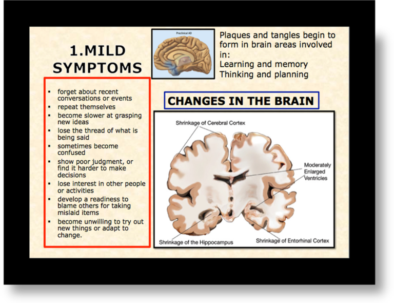 changes-in-brain